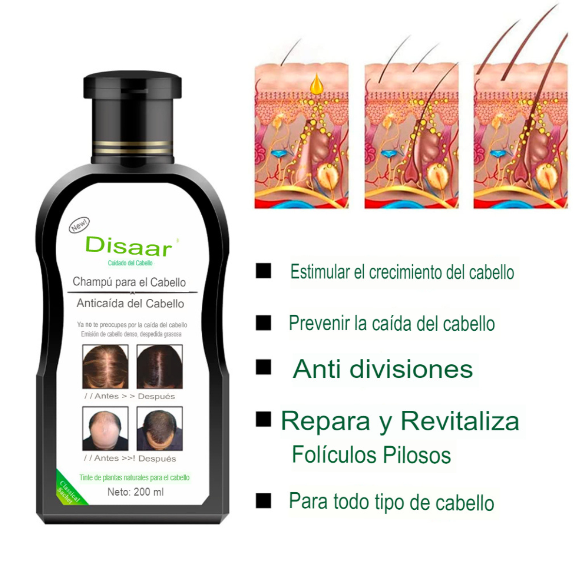 Recupera el Volumen de Tu Cabello – Champú Herbal Anticaída + Suero